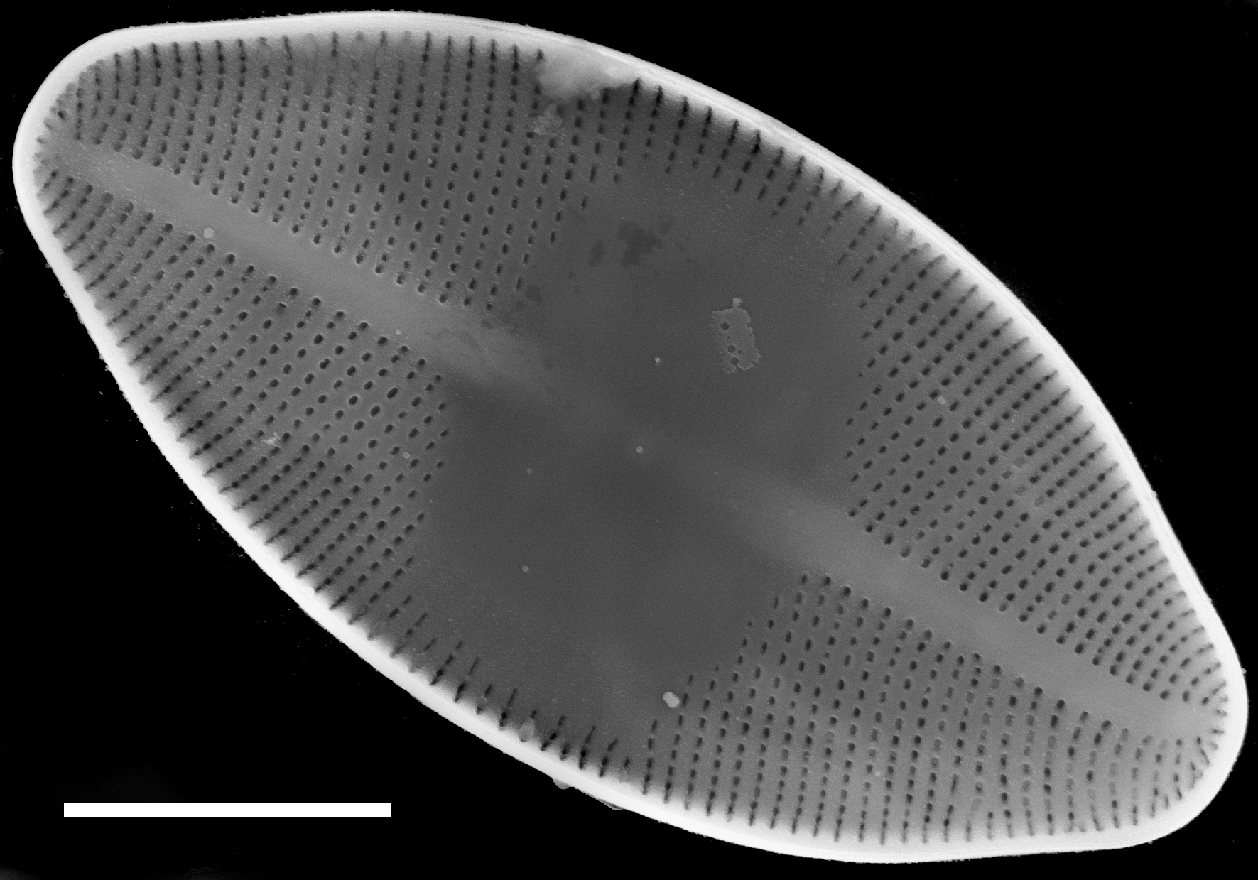 Eucocconeis americana SEM3