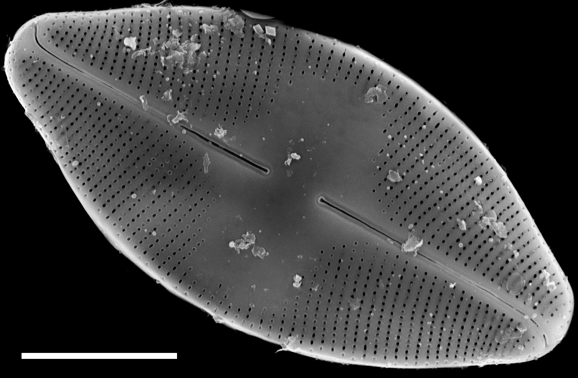 Eucocconeis americana SEM4