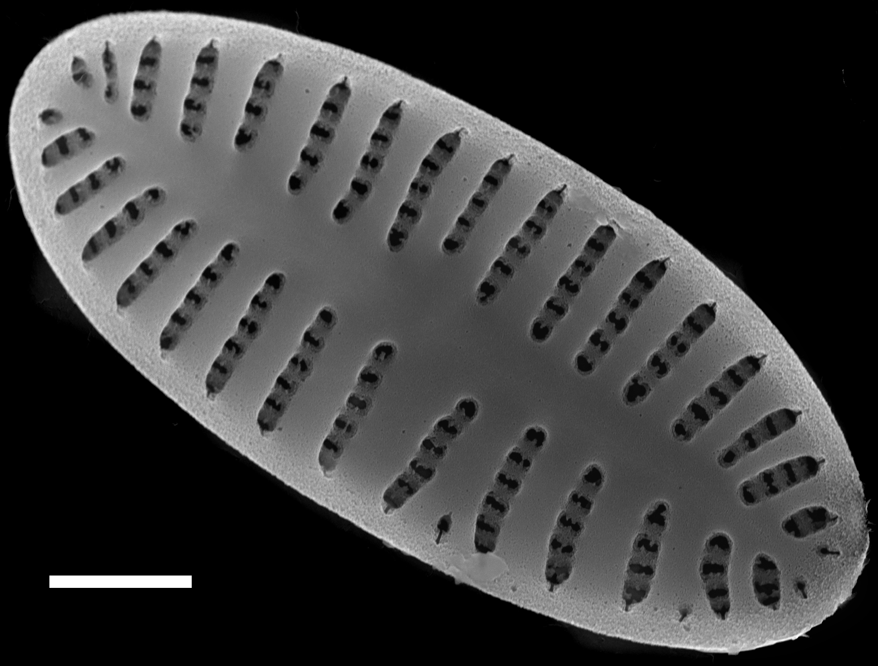 Karayevia oblongella SEM4