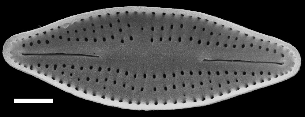 Nupela neglecta SEM2