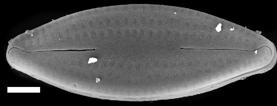 Nupela neglecta SEM4