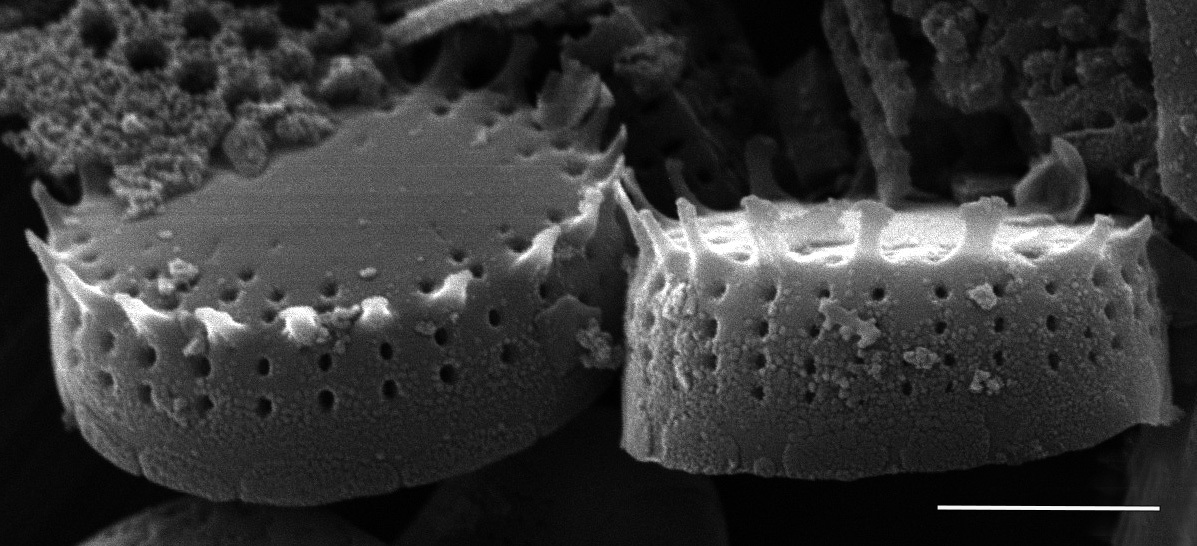 Nanofrustulum cataracterum SEM3