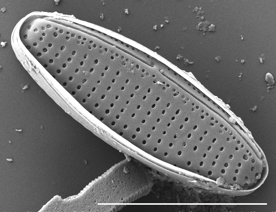 Nitzschia Soratensis Sem1