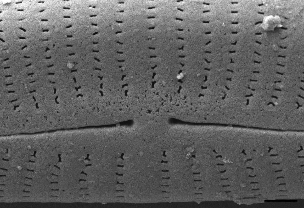 Encyonema norvegicum SEM1