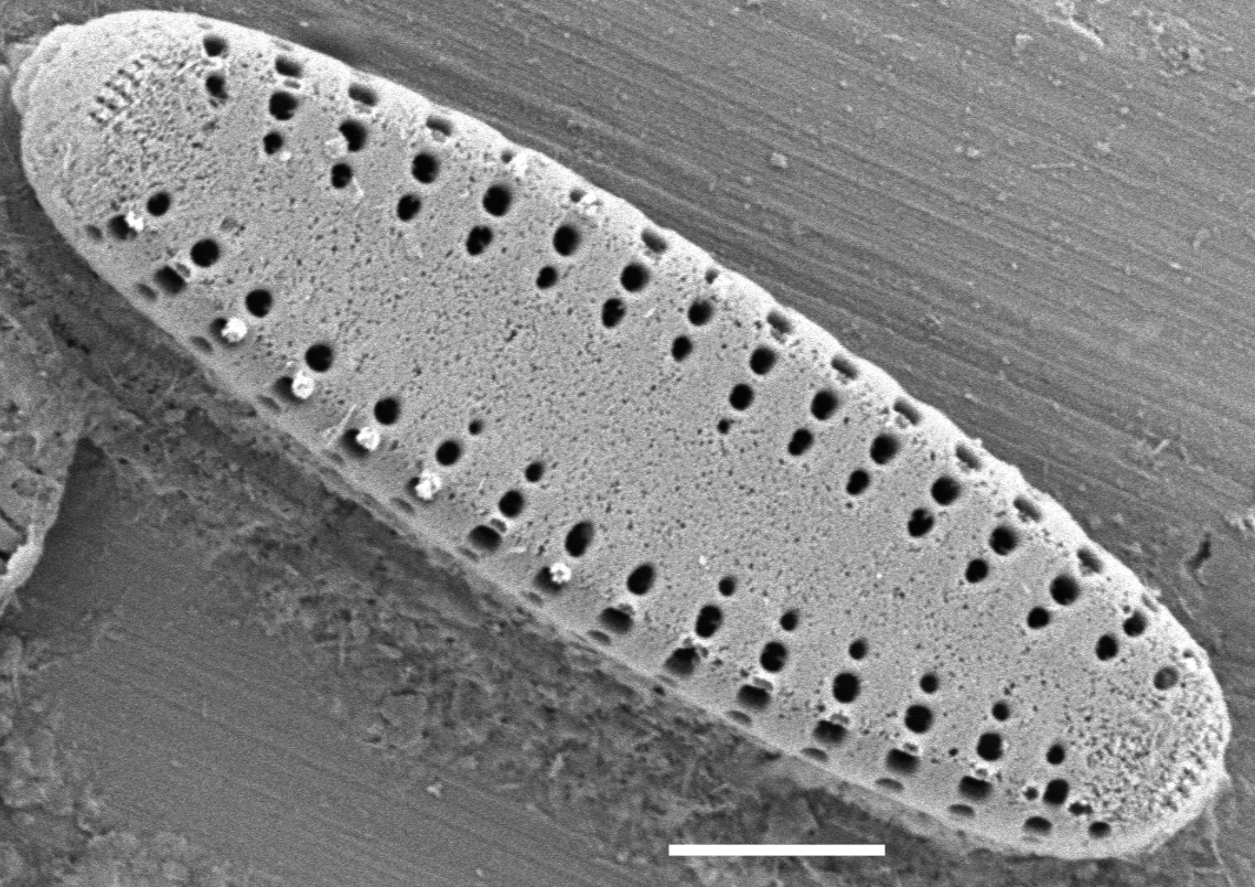 Pseudostaurosira neoelliptica SEM1