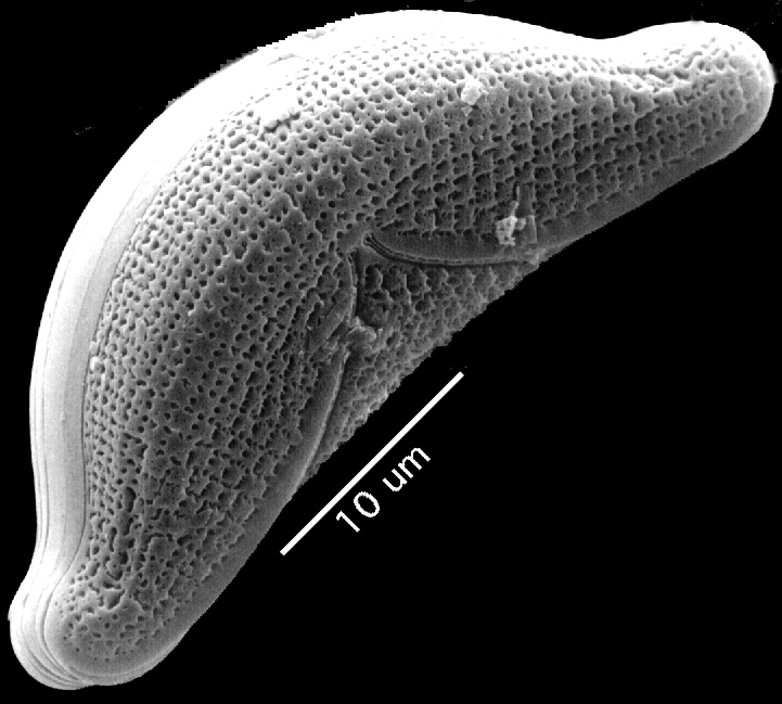 Epithemia sorex SEM1