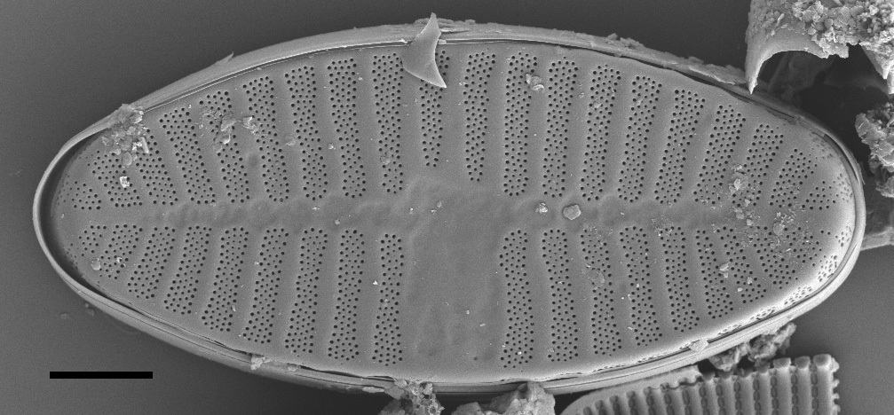 Planothidium Sheathii Sem01