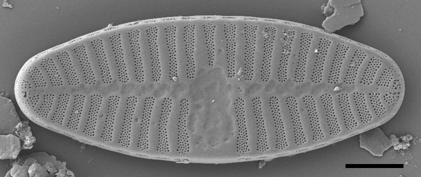 Planothidium Sheathii Sem04