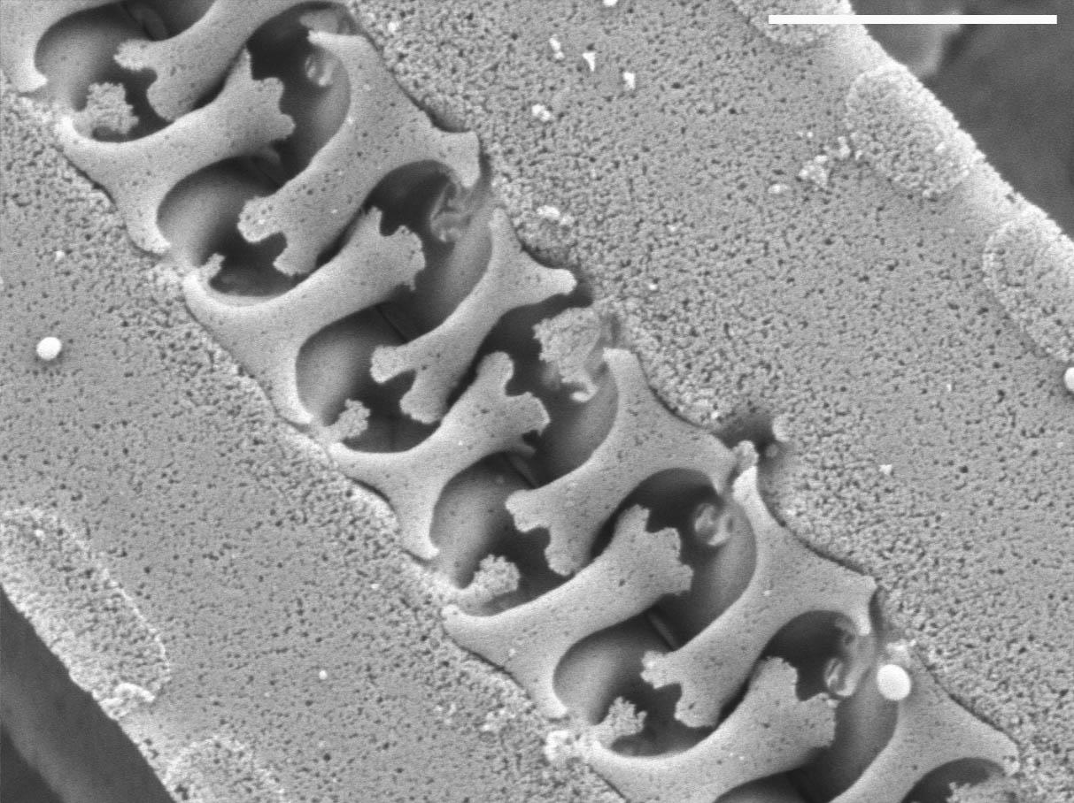 Pseudostaurosira brevistriata SEM1