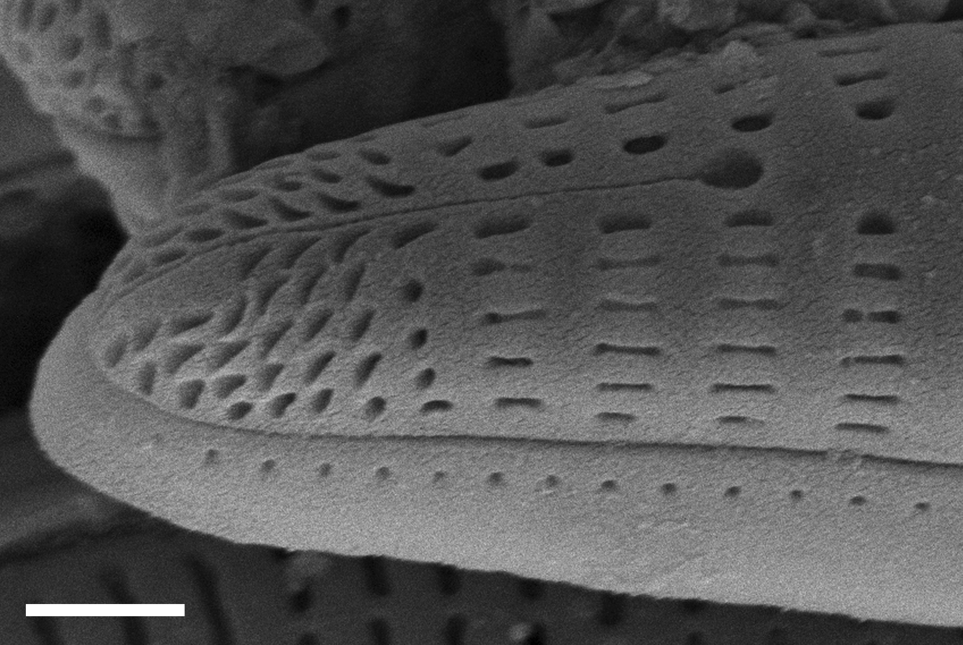 Rhoicosphenia californica SEM4