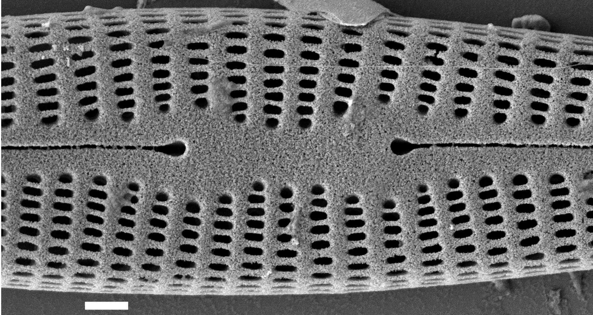 Rhoicosphenia stoermeri SEM4