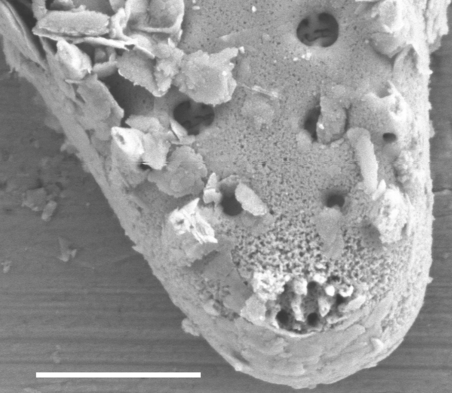 Pseudostaurosira elliptica SEM1