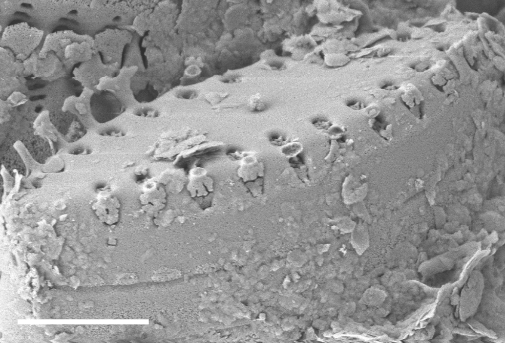 Pseudostaurosira elliptica SEM2