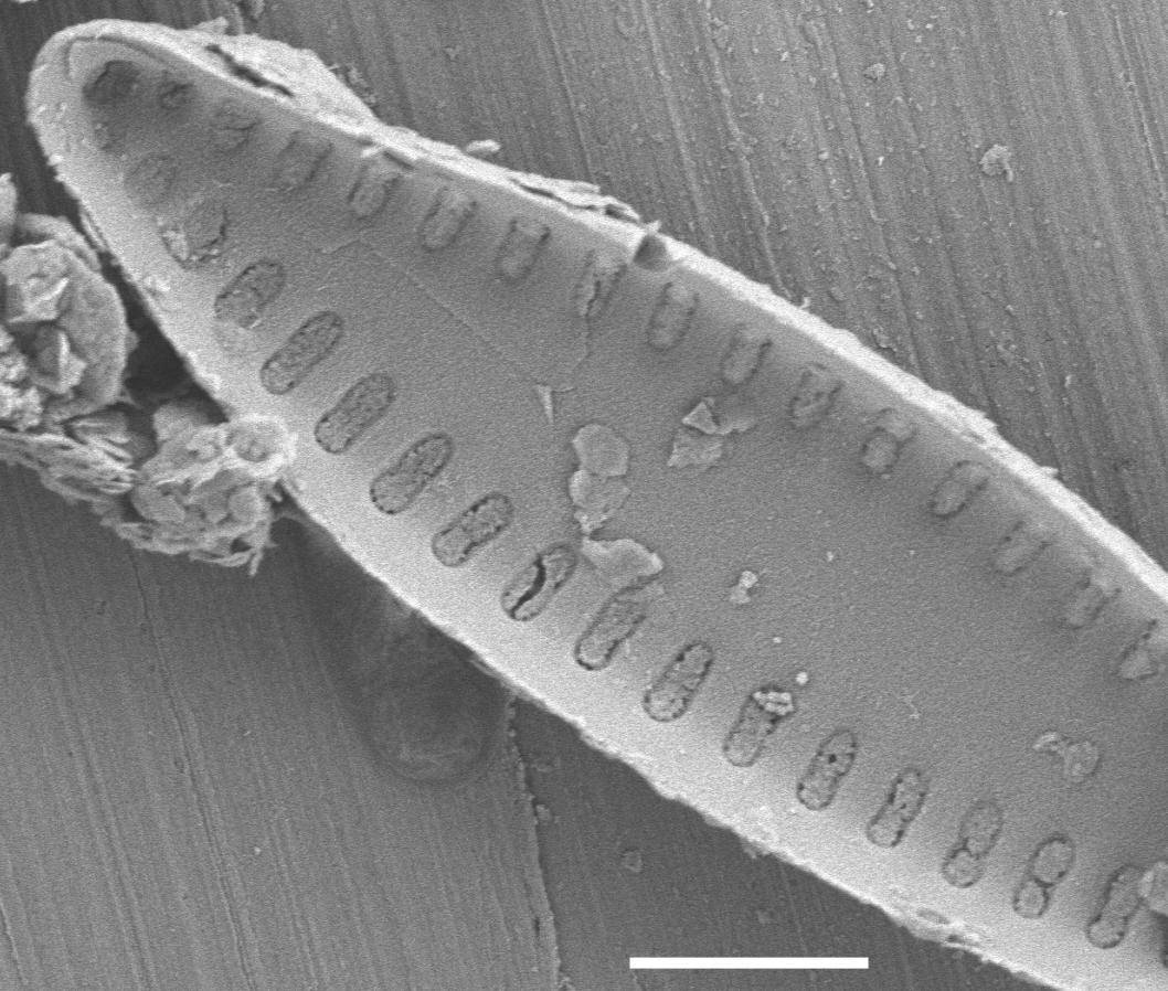 Pseudostaurosira elliptica SEM3