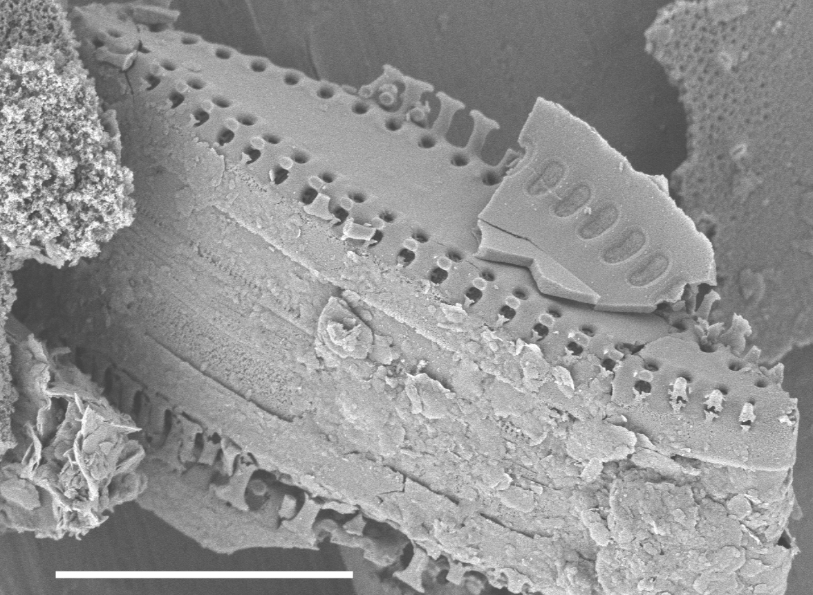 Pseudostaurosira elliptica SEM4