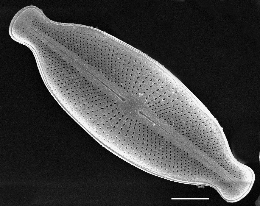 Cosmioneis hawaiiensis SEM2