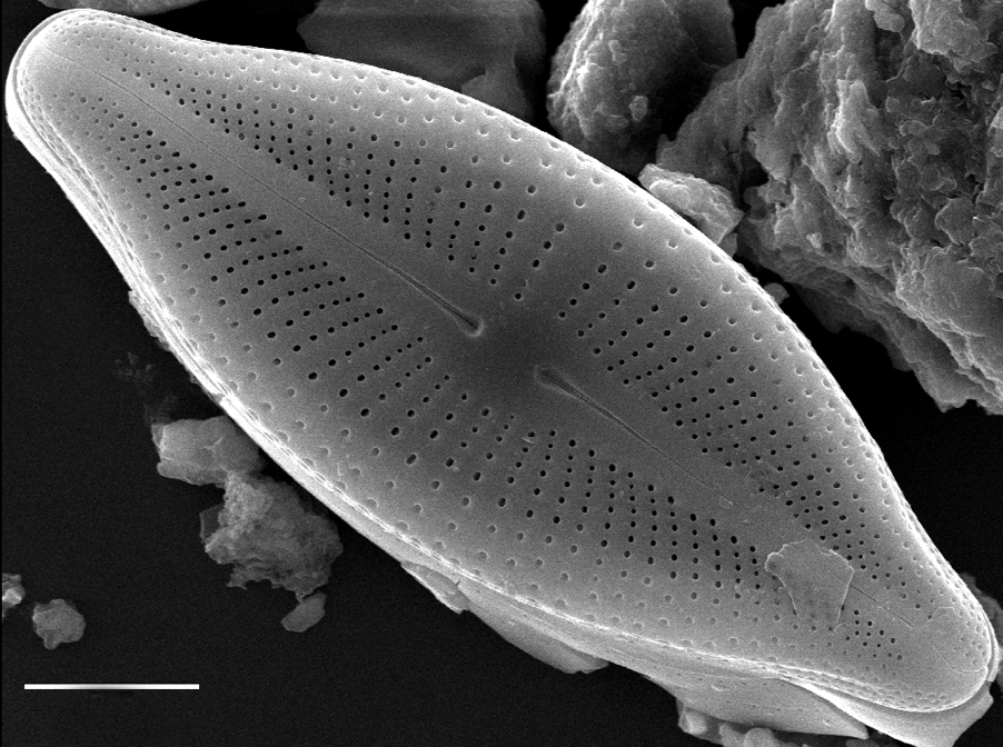 Cosmioneis reimeri SEM1