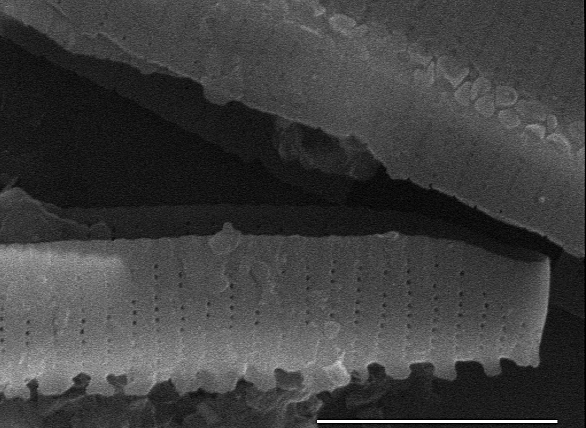 Fragilariforma nitzschioides SEM4