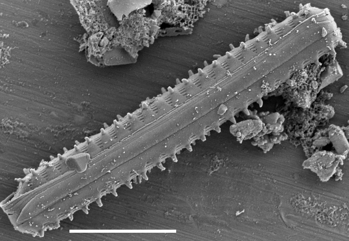 Staurosirella berolinensis SEM1