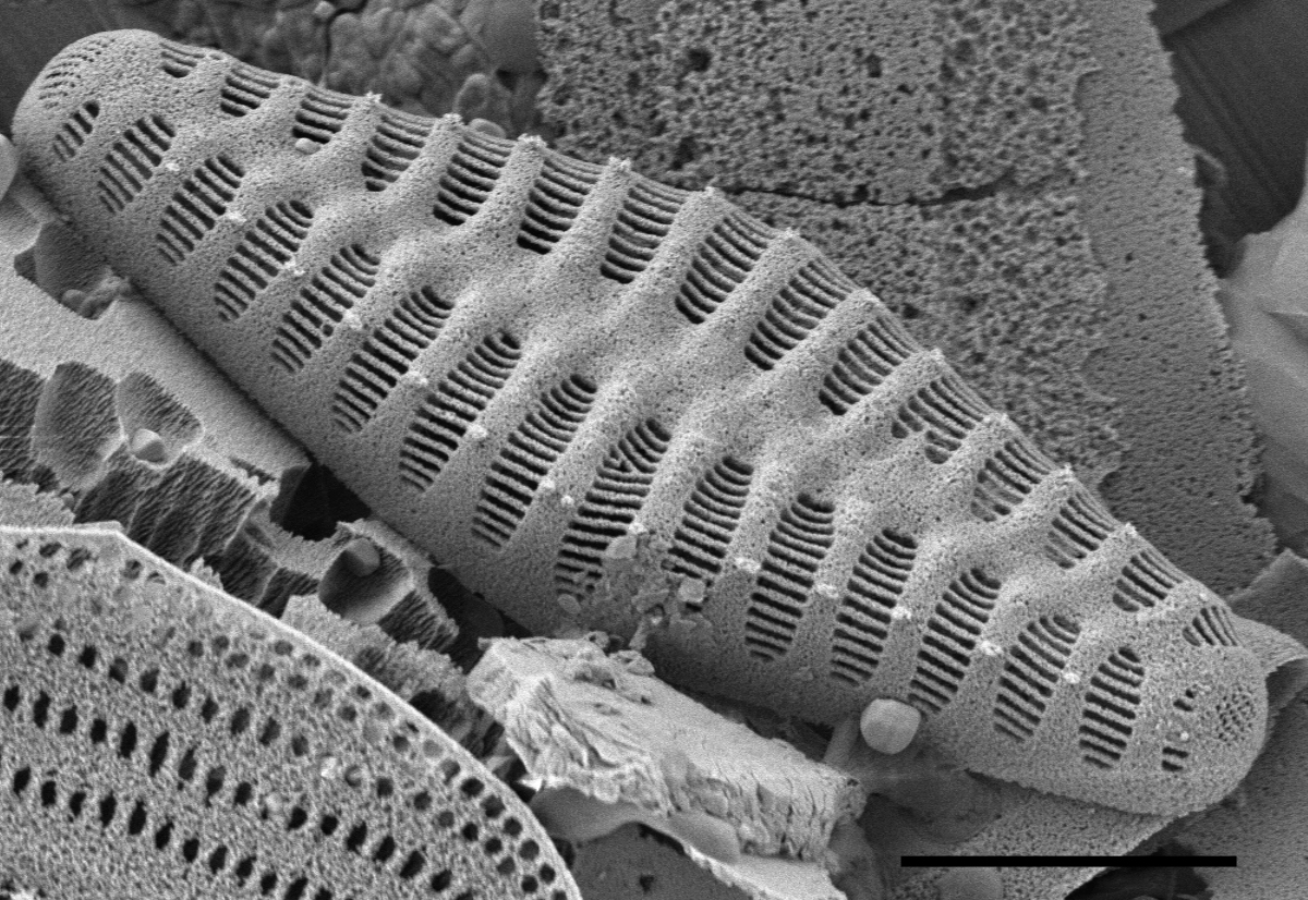 Staurosirella rhomboides SEM2