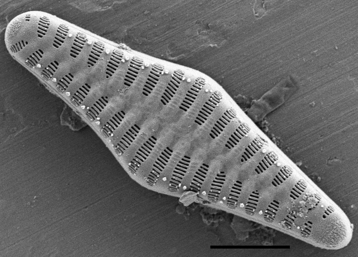 Staurosirella rhomboides SEM1