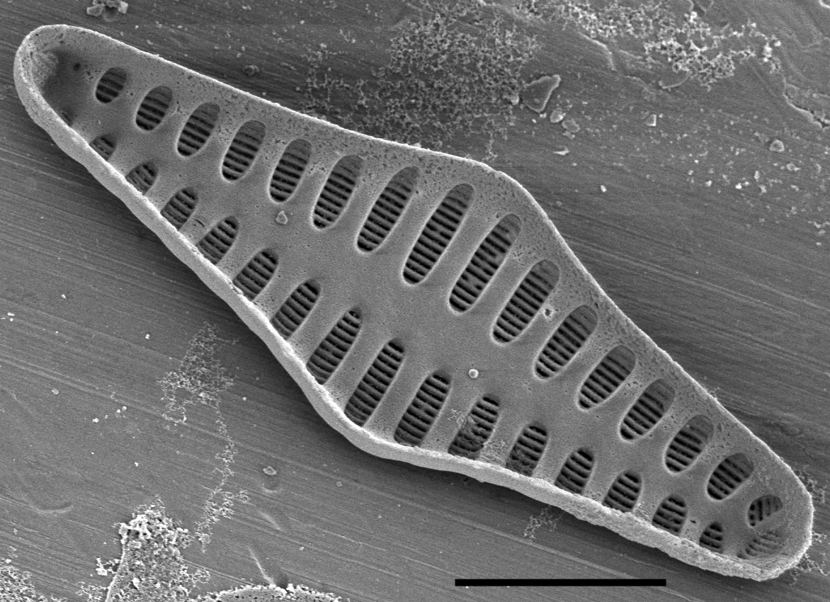 Staurosirella rhomboides SEM3