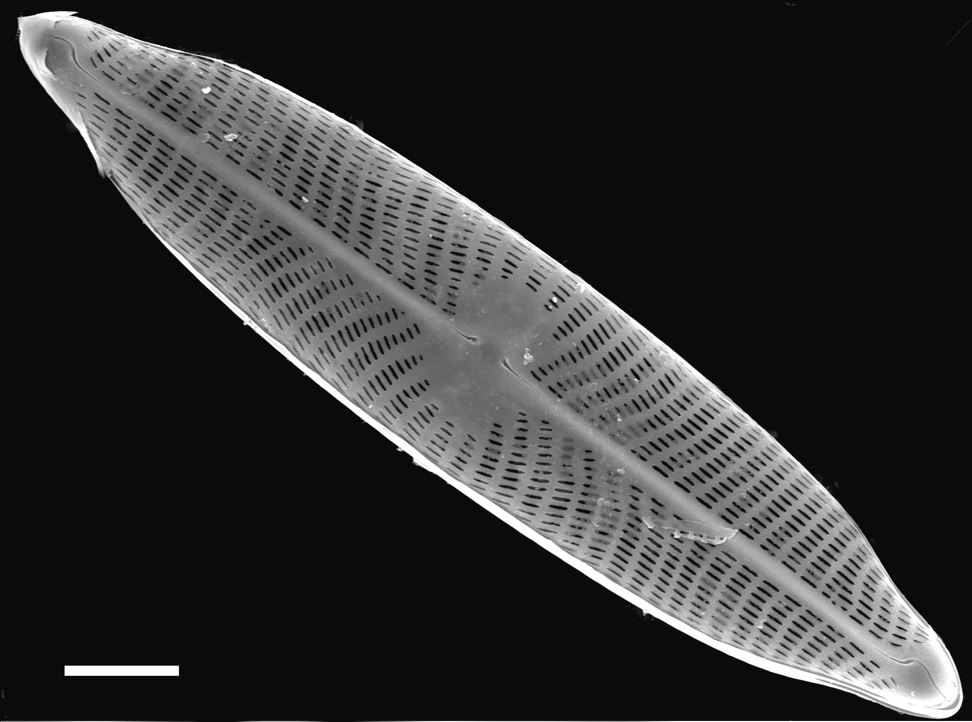 Navicula viridulacalcis subsp neomundana SEM2