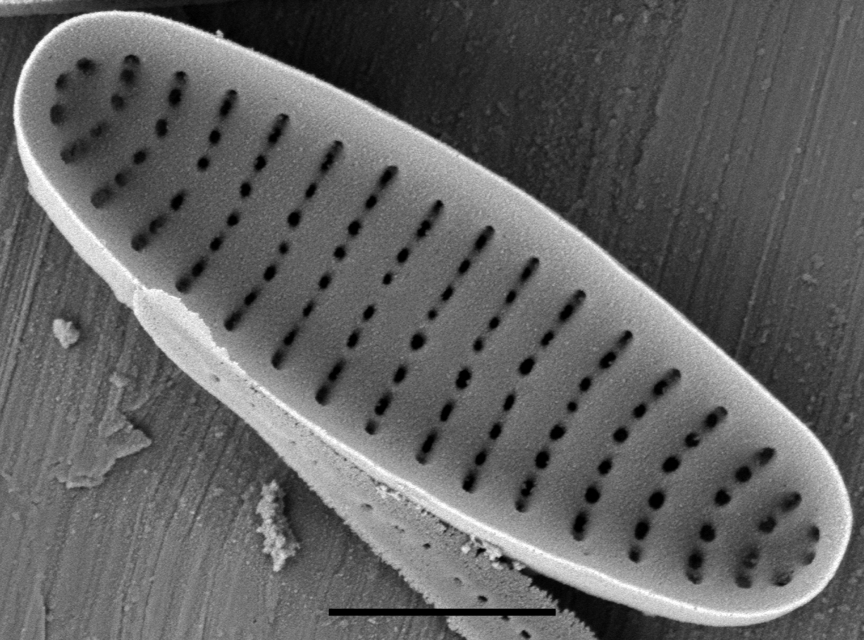 Stauroforma exiguiformis SEM3