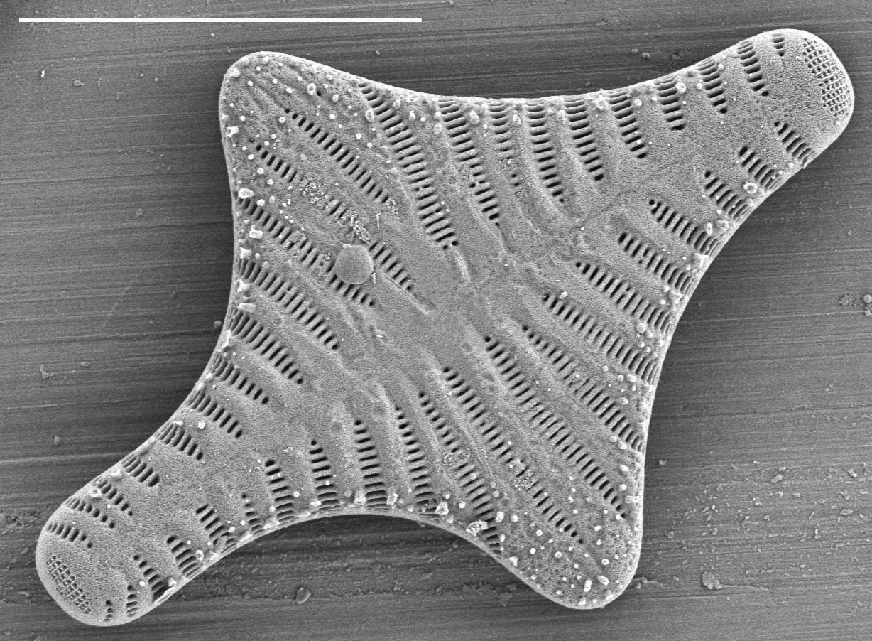 Staurosirella leptostauron SEM1