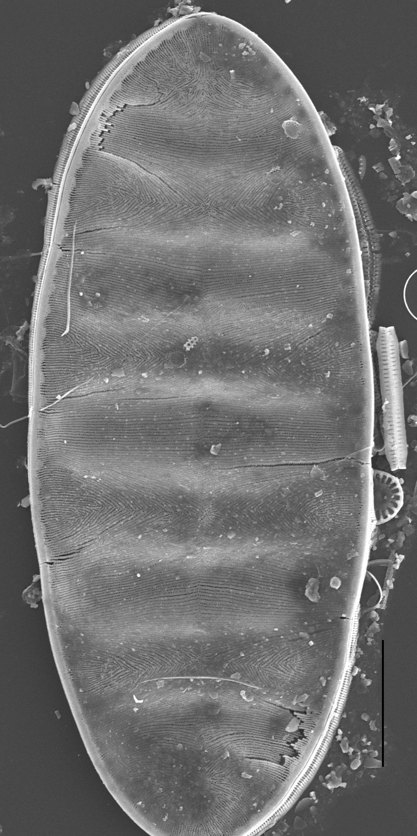 Surirella Undulata Sem 3