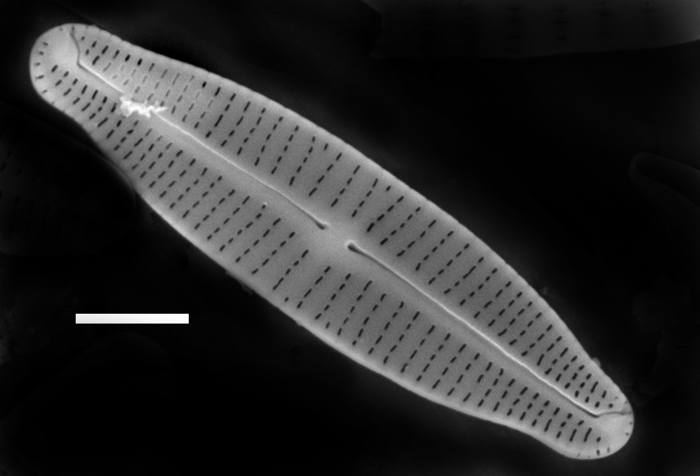 Achnanthidium gracillimum SEM4