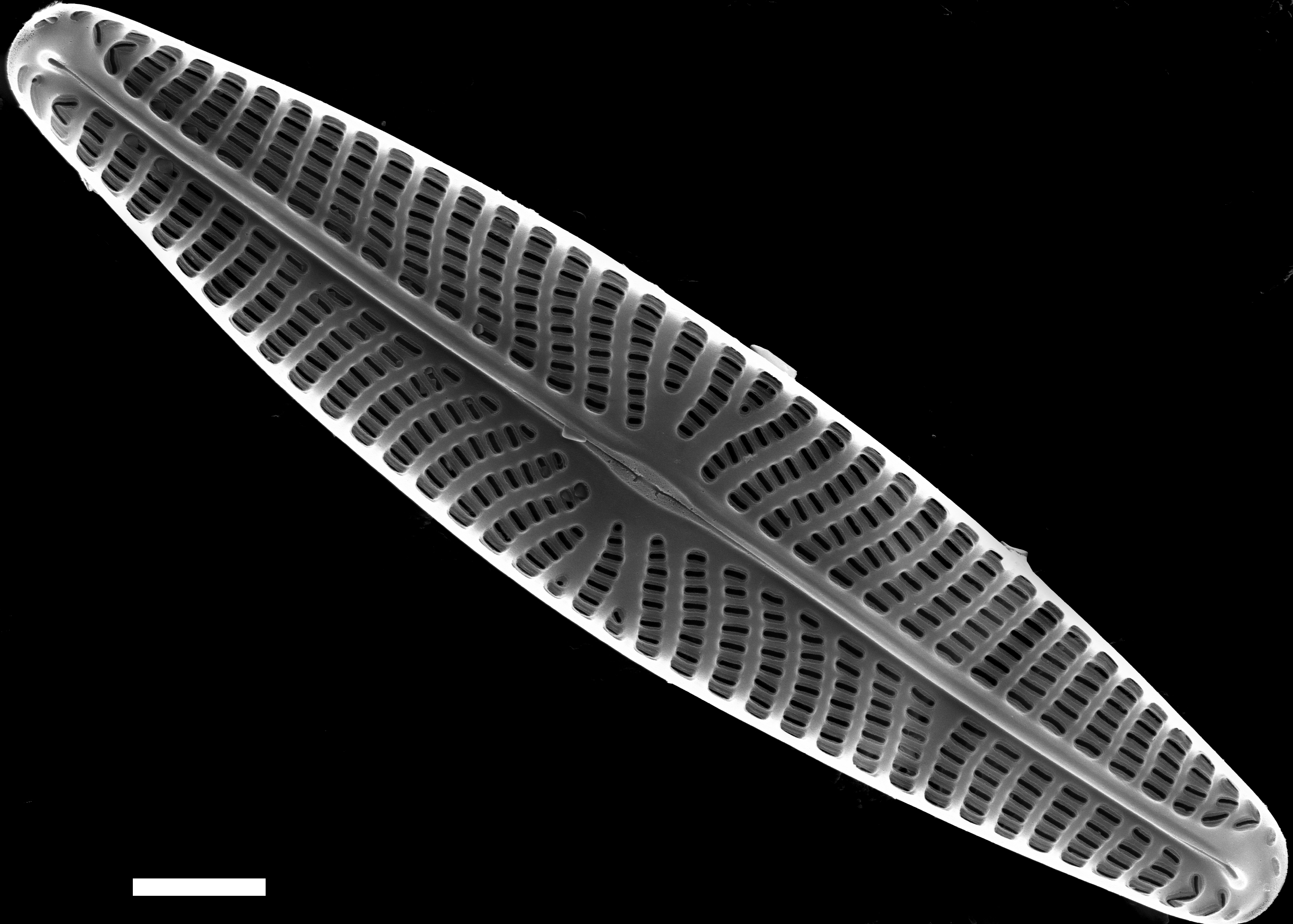 Navicula eileeniae SEM2