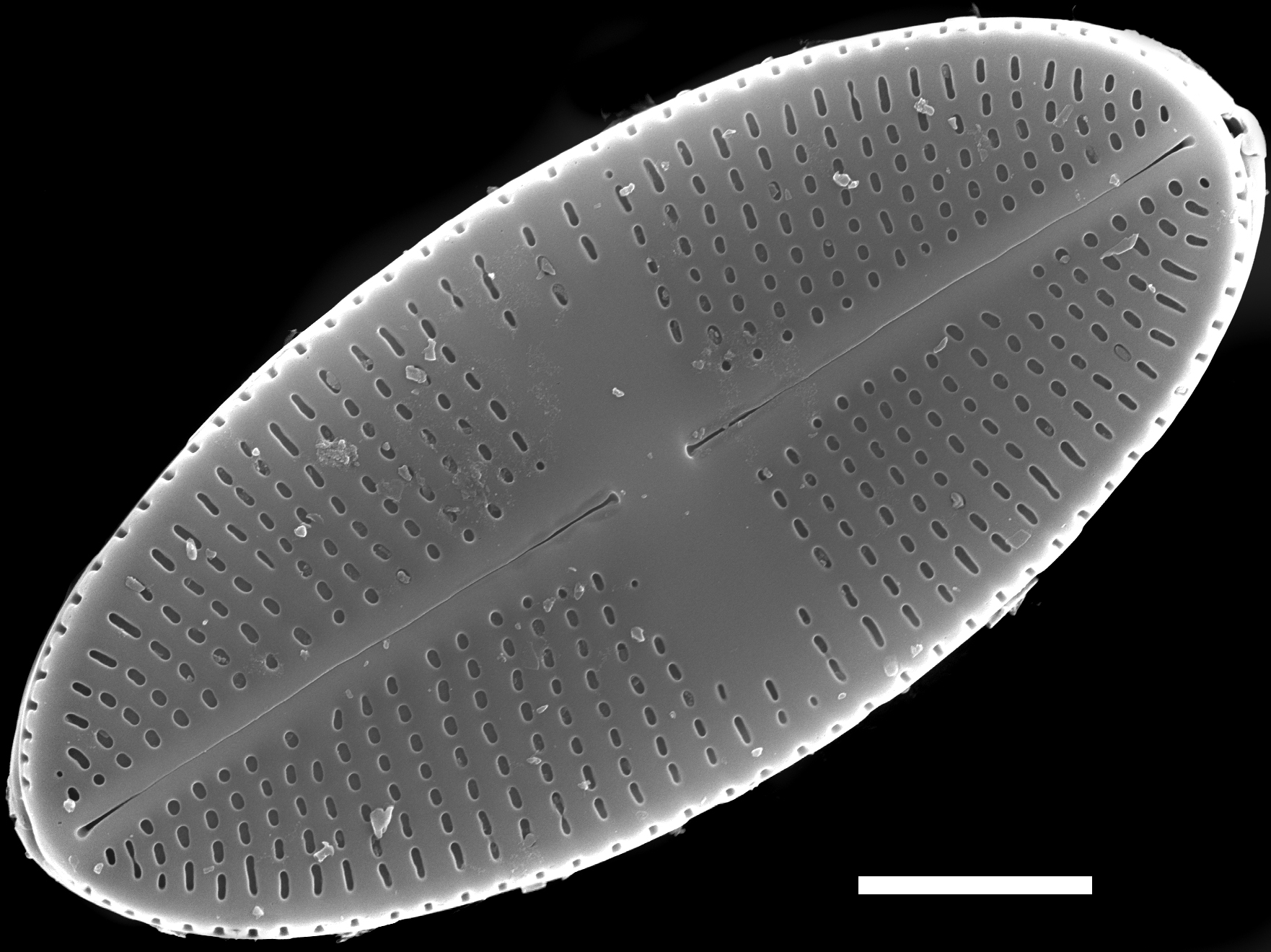 Psammothidium nivale SEM1