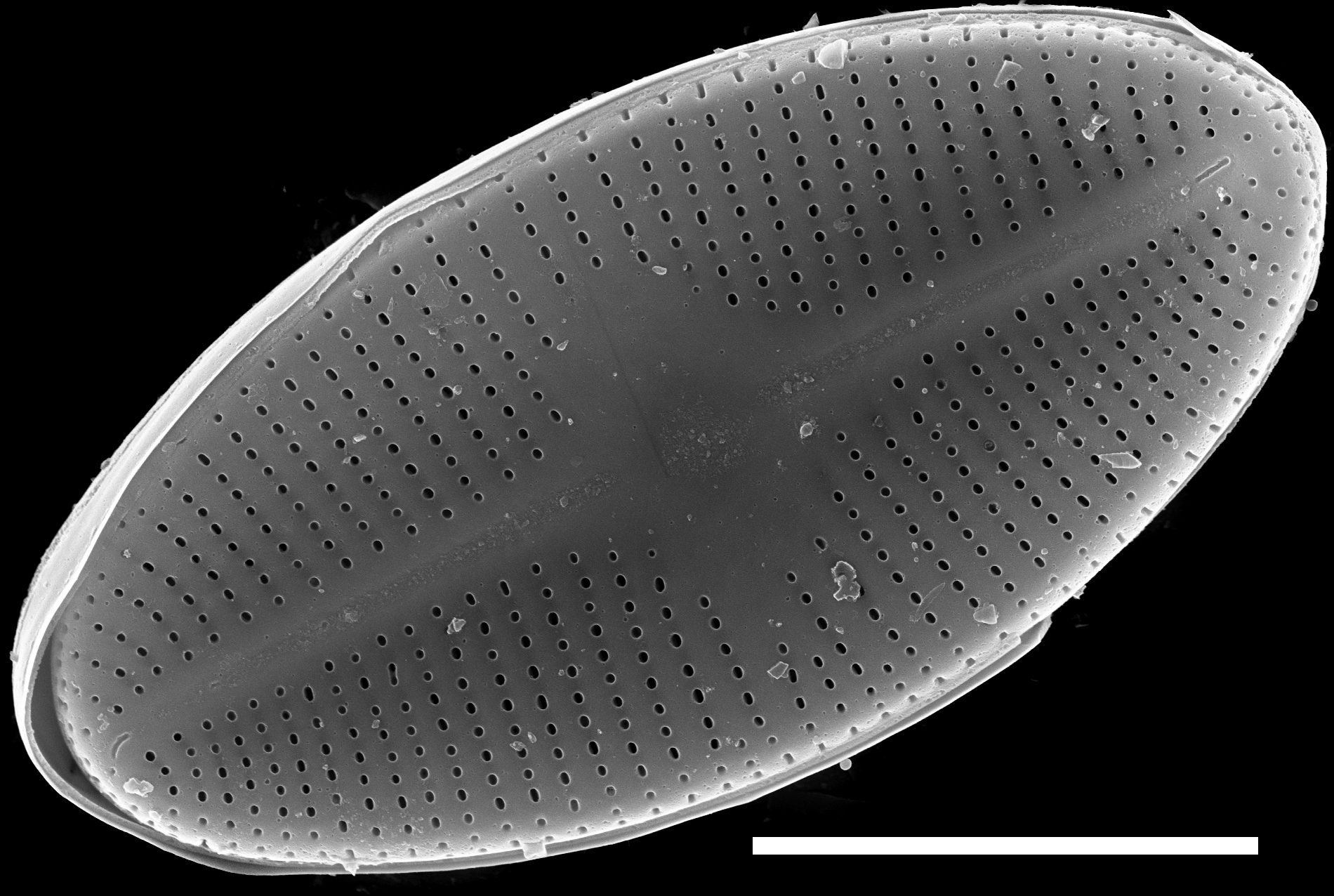 Psammothidium lacustre SEM2