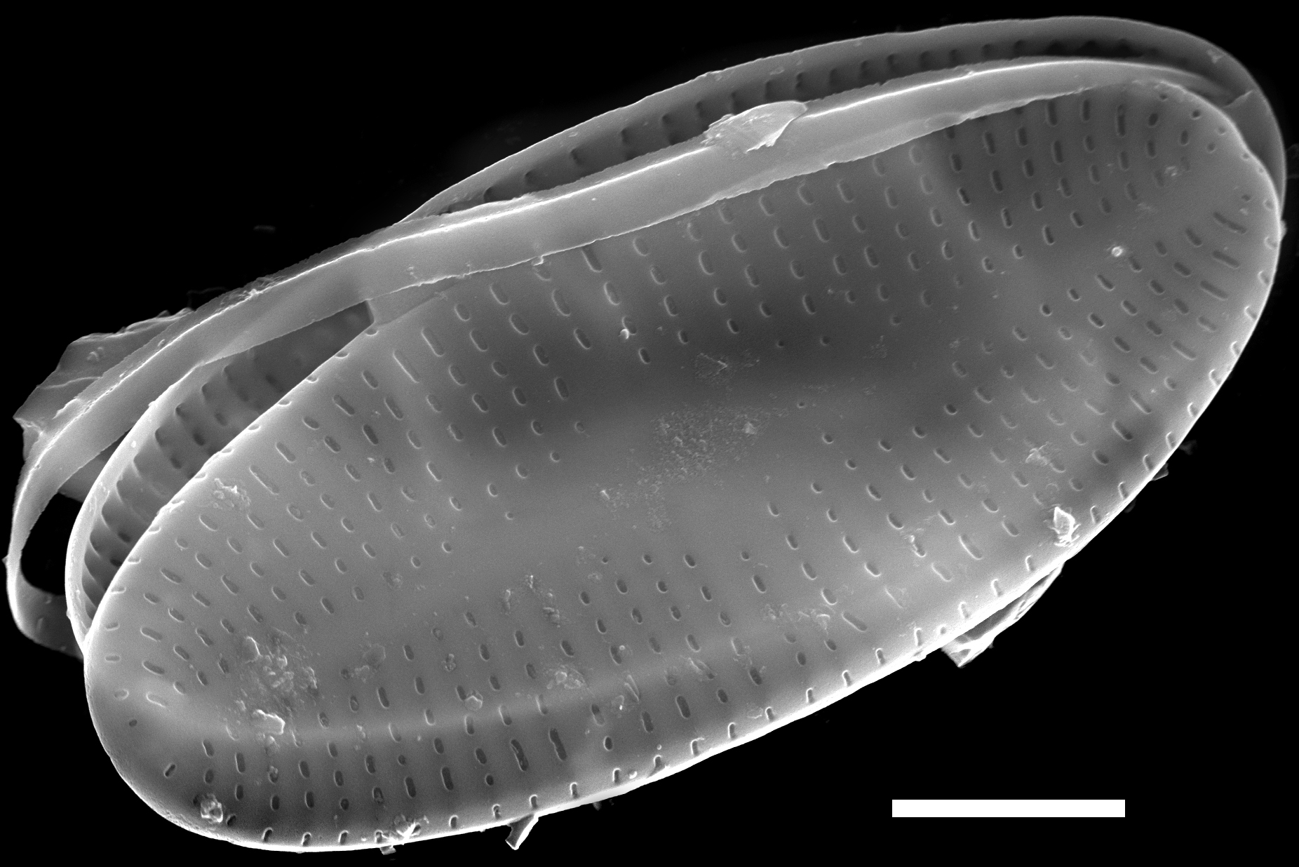 Psammothidium nivale SEM2