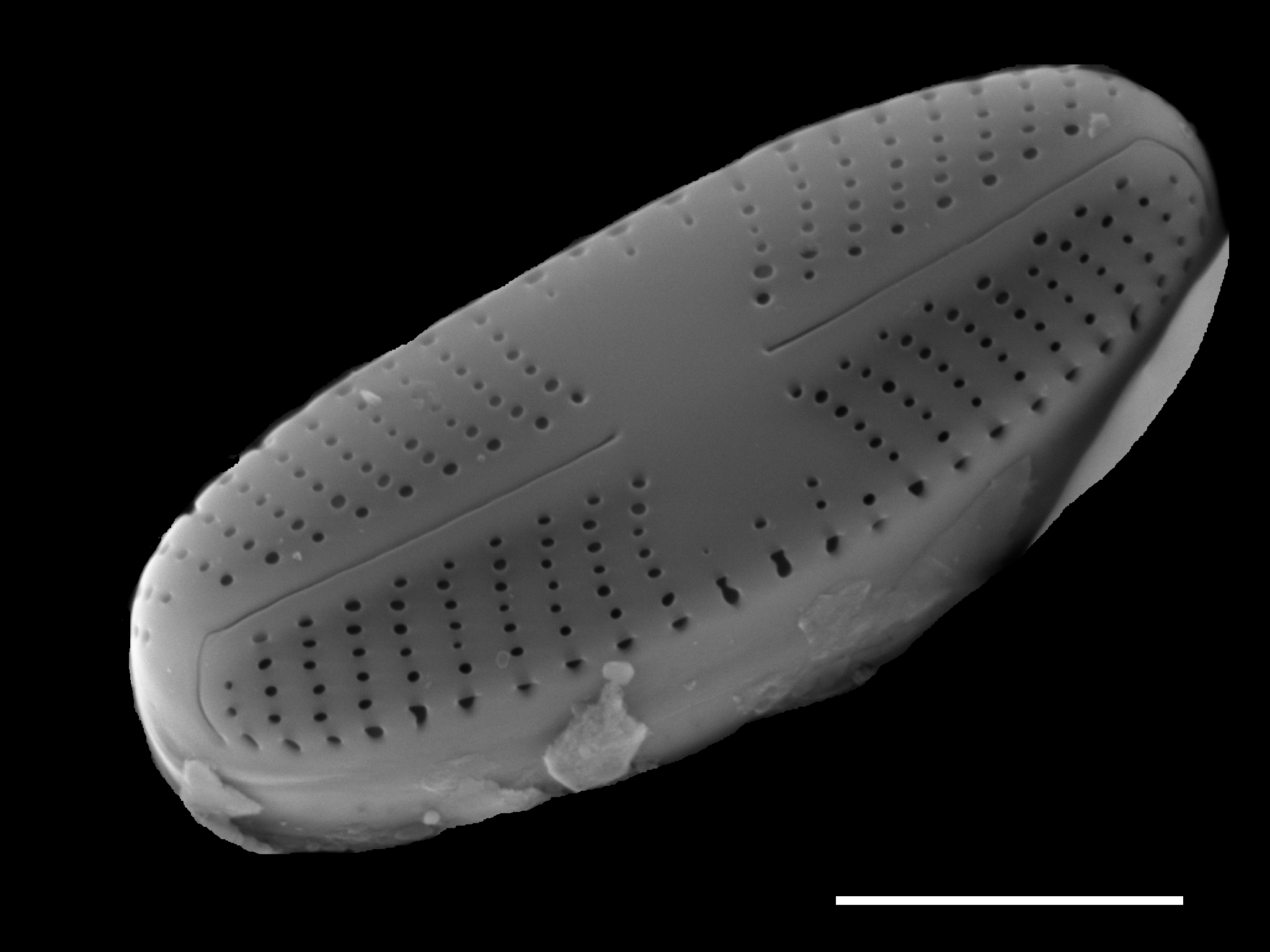 Sellaphora atomoides SEM1