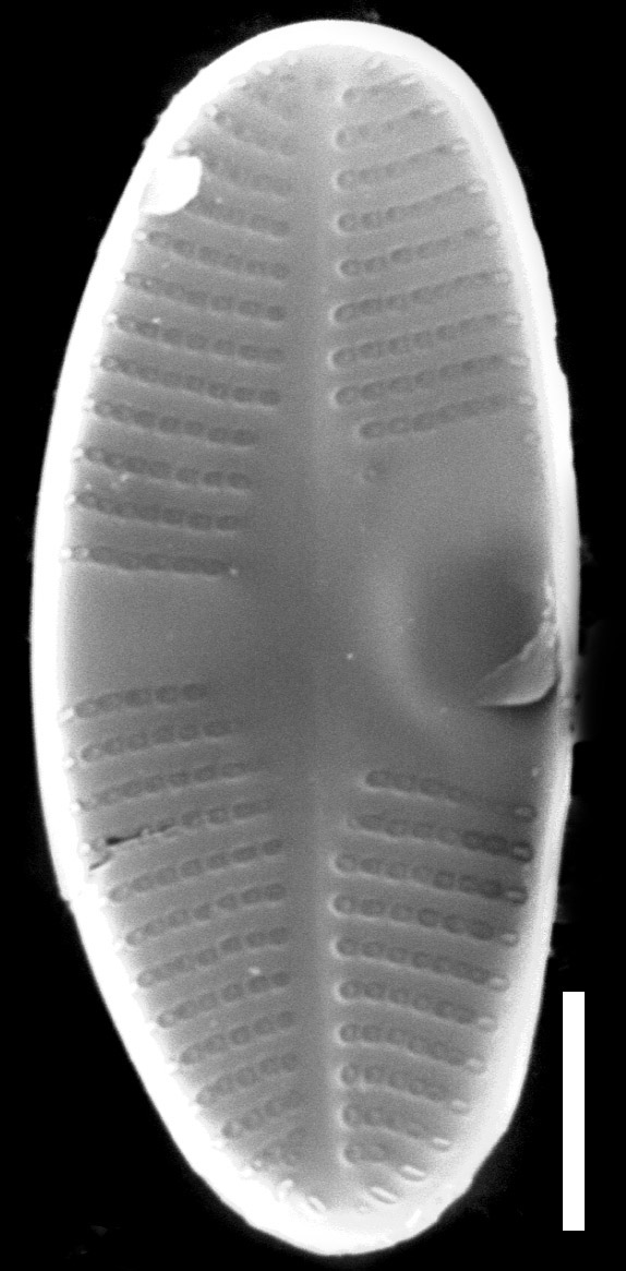 Psammothidium lauenburgianum SEM1