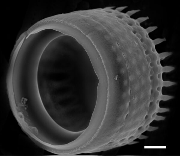 Aulacoseira alpigena SEM2