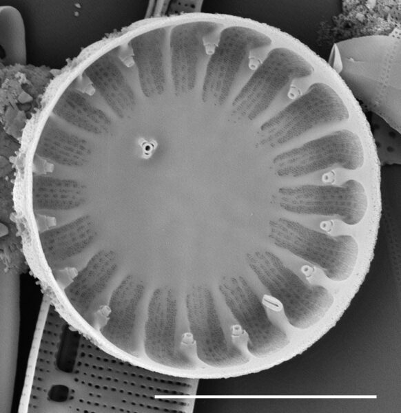 Cyclotella menenghiniana SEM4