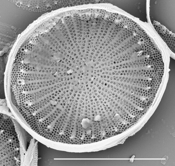 Stephanodiscus hantzschii f tenuis SEM3