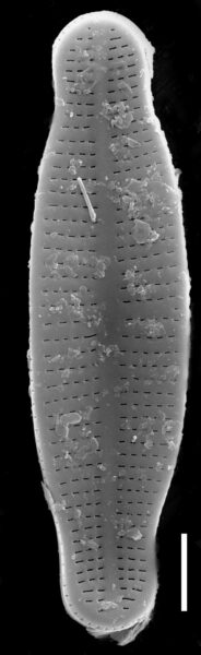 Achnanthidium latecephalum SEM1