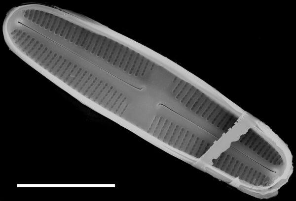 Rossithidium petersenii SEM1