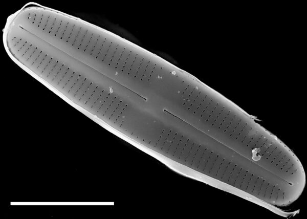 Rossithidium petersenii SEM2