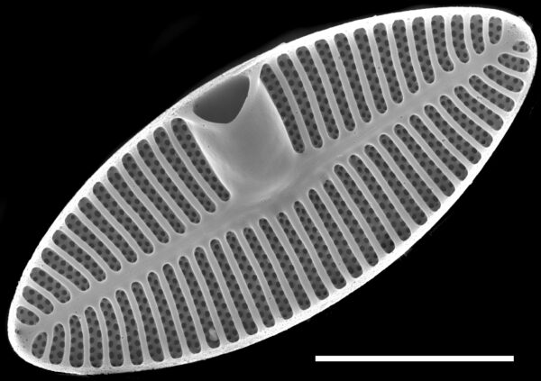 Planothidium oestrupii SEM1