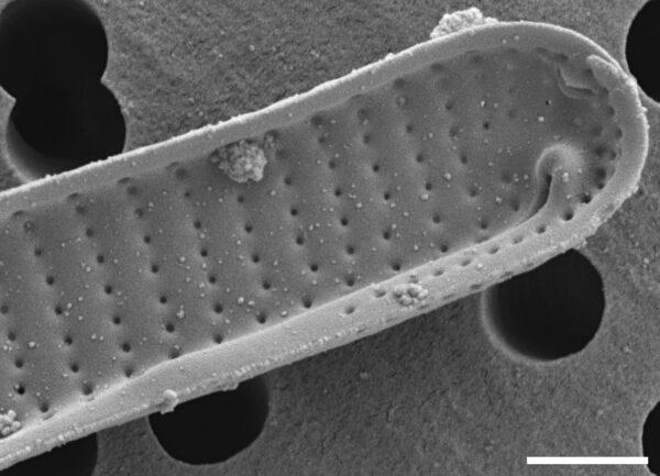 Eunotia mucophila SEM1