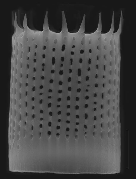 Aulacoseira nivaloides SEM1