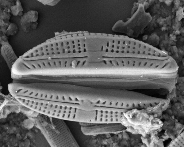 Amphora pediculus SEM1