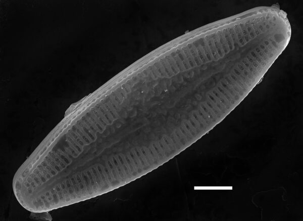 Nupela poconoensis SEM2