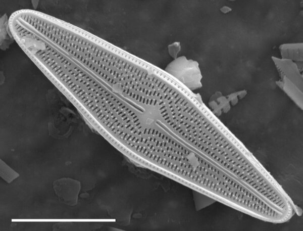 Brachysira brebissonii SEM1