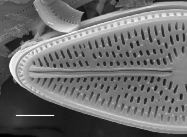 Brachysira brebissonii SEM3